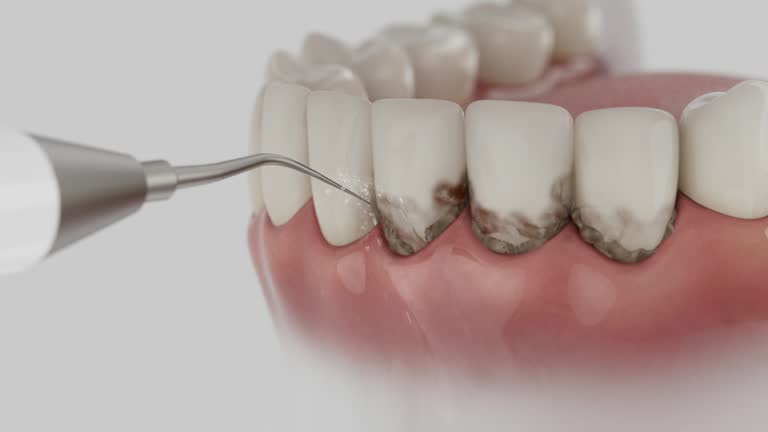 Trusted Teeth Cleaning And Checkup service in Novi, MI - Dentist Open Now